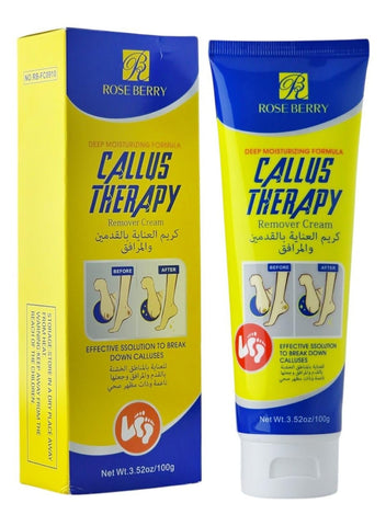 Rose Berry - Callus Therapy Remover Cream (Original)